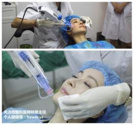 除婕明星,闪耀舞台的璀璨之星